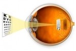 sve vrste oftalmoloških pregleda, kod dece i odraslih koji obuhvataju predele prednjeg i zadnjeg segmenta oka.